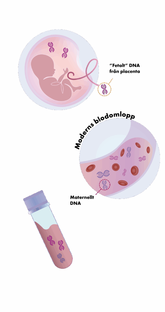 Babyscreen NIPT Fetal DNA2 30 20