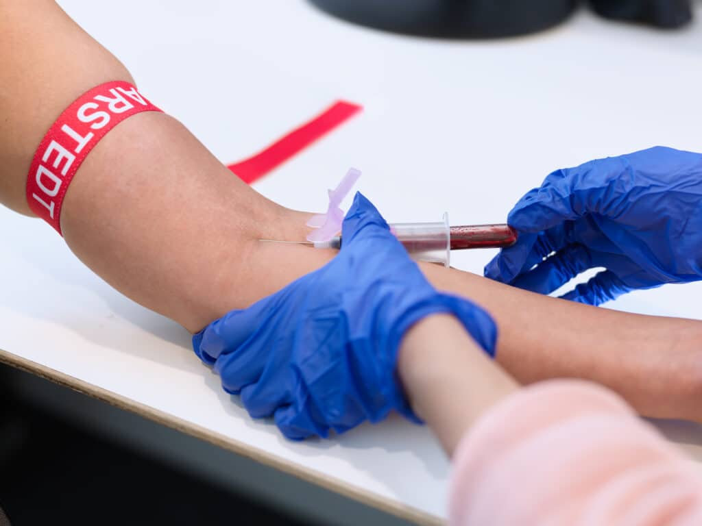 Viktigt att veta innan du lämnar prov