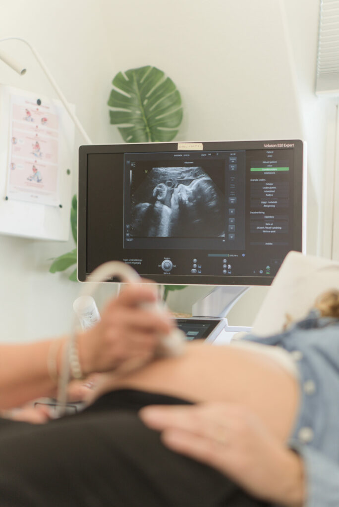 rutinultraljud RUL babyscreen scaled 1